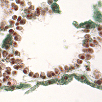 leuclathrina_translucida_sec